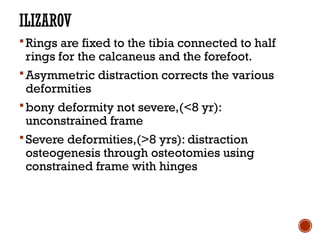 Constrained Ring CTEV presentation for seminar final.pptx