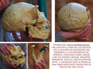 CRÁNEO DEL Homo heidelbergensis,
HALLADO EN LA SIMA DE LOS HUESOS,
(EN LA GALERÍA SE ENCONTRÓ UNA
MANDÍBULA Y UN FRAGMENTO DE
CRÁNEO). CONOCIDO COMO “MIGUELÓN” EN HONOR A MIGUEL INDURAÍN.
PRESENTA ROTO EL ARCO SUPRAORBITAL Y UN DIENTE QUE LE PRODUJO
UNA GRAN INFECCIÓN. QUIZÁS SEA EL
TROFEO DE UNA LUCHA.

 