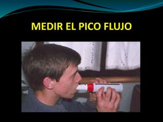 MEDIR EL PICO FLUJO
 
