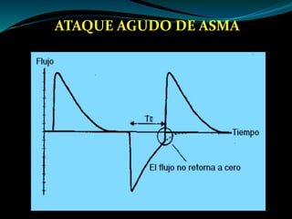 ATAQUE AGUDO DE ASMA
 