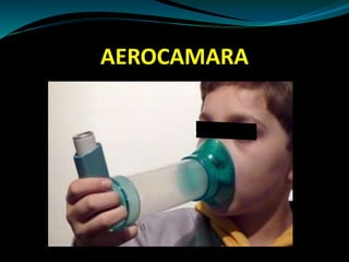 AEROCAMARA
 