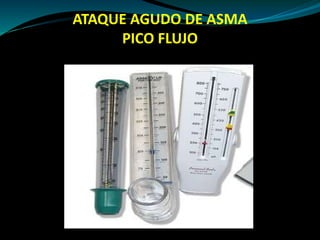 ATAQUE AGUDO DE ASMA
Pico flujo espiratorio:
Fácil acceso
Bajo costo
Limitado uso en casos severos o pacientes con
dificul...