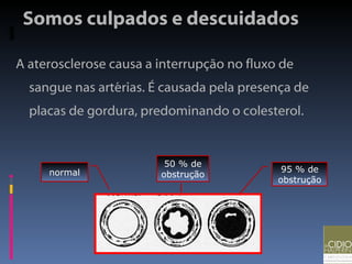 Somos culpados e descuidados A aterosclerose causa a interrupção no fluxo de sangue nas artérias. É causada pela presença de placas de gordura, predominando o colesterol. 95 % de obstrução normal 50 % de obstrução 