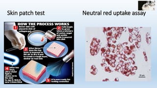 Skin patch test Neutral red uptake assay
 