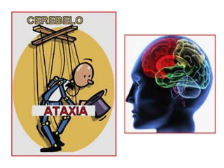 Ataxia