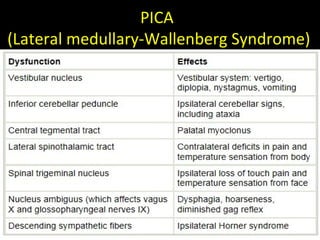 PICA
(Lateral medullary-Wallenberg Syndrome)
 