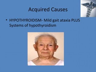 Acquired Causes
• HYPOTHYROIDISM- Mild gait ataxia PLUS
Systems of hypothyroidism
 