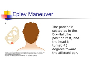 Epley Maneuver

             The patient is
             seated as in the
             Dix-Hallpike
             position test, and
             the head is
             turned 45
             degrees toward
             the affected ear.
 