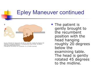 Epley Maneuver continued
               The patient is
                gently brought to
                the recumbent
                position with the
                head hanging
                roughly 20 degrees
                below the
                examining table.
                The head is gently
                rotated 45 degrees
                to the midline.
 