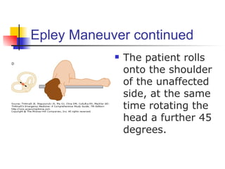 Epley Maneuver continued
               The patient rolls
                onto the shoulder
                of the unaffected
                side, at the same
                time rotating the
                head a further 45
                degrees.
 