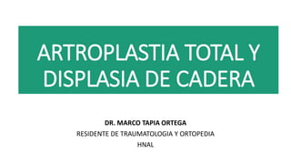 ARTROPLASTIA TOTAL Y
DISPLASIA DE CADERA
DR. MARCO TAPIA ORTEGA
RESIDENTE DE TRAUMATOLOGIA Y ORTOPEDIA
HNAL
 