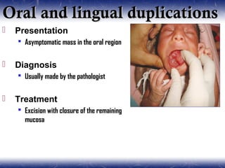 Oral and lingual duplicationsOral and lingual duplications
 Presentation
 Asymptomatic mass in the oral region
 Diagnosis
 Usually made by the pathologist
 Treatment
 Excision with closure of the remaining
mucosa
 