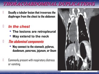 THORACOABDOMINAL DUPLICATIONSTHORACOABDOMINAL DUPLICATIONS
 Usually a tubular lesion that traverses the
diaphragm from the chest to the abdomen
 In the chest
 The lesions are retropleural
 May extend to the neck
 The abdominal components
 May connect to the stomach, pylorus,
duodenum, pancreas, jejunum, or ileum
 Commonly present with respiratory distress
or vomiting
 