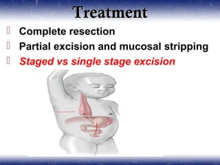 TreatmentTreatment
 Complete resection
 Partial excision and mucosal stripping
 Staged vs single stage excision
 