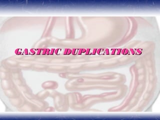 GASTRIC DUPLICATIONSGASTRIC DUPLICATIONS
 