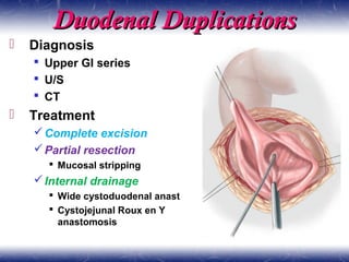 Duodenal DuplicationsDuodenal Duplications
 Diagnosis
 Upper GI series
 U/S
 CT
 Treatment
Complete excision
Partial resection
 Mucosal stripping
Internal drainage
 Wide cystoduodenal anast
 Cystojejunal Roux en Y
anastomosis
 
