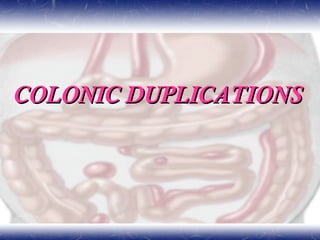 COLONIC DUPLICATIONSCOLONIC DUPLICATIONS
 