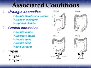 Associated ConditionsAssociated Conditions
 Urologic anomalies
Double bladder and urethra
Bladder exstrophy
septated bladder
 Genital anomalies
Double vagina,
Didelphic uterus
Double vulva
Double penis
Bifid scrotum
 Types
 Type I
 Type II
 