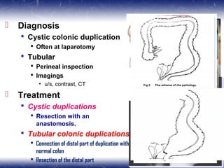  Diagnosis
 Cystic colonic duplication
 Often at laparotomy
 Tubular
 Perineal inspection
 Imagings
• u/s, contrast, CT
 Treatment
 Cystic duplications
 Resection with an
anastomosis.
 Tubular colonic duplications
 Connection of distal part of duplication with
normal colon
 Resection of the distal part
 