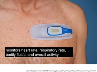 http://medgadget.com/archives/2010/01/corventis_gets_us_ok_for_wireless_cardiac_arrhythmia_monitoring_system.html
monitors heart rate, respiratory rate,
bodily fluids, and overall activity
 