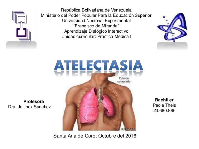 Atelectasia