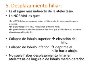 5. Desplazamiento hiliar:
• Es el signo mas indirecto de la atelectasia.
• Lo NORMAL es que:
  •En el 97% de las personas normales el hilio izquierdo esta mas alto que el
  derecho.
  •En el 3% de los casos los 2 hilios están al mismo nivel.
  •En general no existe individuos normales en el que el hilio derecho este mas
  elevado que el izquierdo.


• Colapso de lóbulo superior  elevación del
                                      hilio.
• Colapso de lóbulo inferior  deprime el
                               hilio hacia abajo.
• No suele haber desplazamiento hiliar en
  atelectasia de lingula o de lóbulo medio derecho.
 