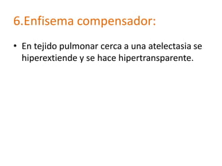 6.Enfisema compensador:
• En tejido pulmonar cerca a una atelectasia se
  hiperextiende y se hace hipertransparente.
 