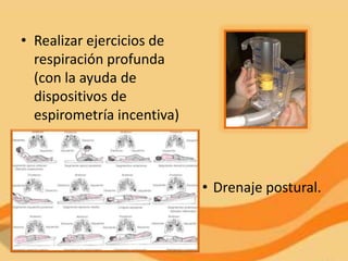 • Realizar ejercicios de
  respiración profunda
  (con la ayuda de
  dispositivos de
  espirometría incentiva)



                            • Drenaje postural.
 