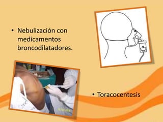 • Nebulización con
  medicamentos
  broncodilatadores.




                       • Toracocentesis
 