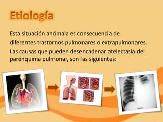 Esta situación anómala es consecuencia de
diferentes trastornos pulmonares o extrapulmonares.
Las causas que pueden desencadenar atelectasia del
parénquima pulmonar, son las siguientes:
 