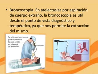 • Broncoscopia. En atelectasias por aspiración
  de cuerpo extraño, la broncoscopia es útil
  desde el punto de vista diagnóstico y
  terapéutico, ya que nos permite la extracción
  del mismo.
 