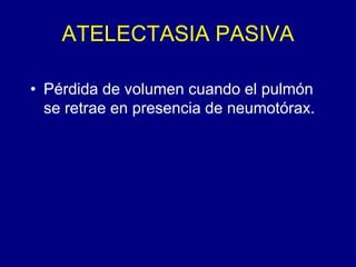 ATELECTASIA PASIVA
• Pérdida de volumen cuando el pulmón
se retrae en presencia de neumotórax.
 