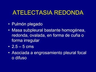 ATELECTASIA REDONDA
• Pulmón plegado
• Masa subpleural bastante homogénea,
redonda, ovalada, en forma de cuña o
forma irregular
• 2.5 – 5 cms
• Asociada a engrosamiento pleural focal
o difuso
 