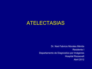 ATELECTASIAS
Dr. Noé Fabricio Morales Mérida
Residente I
Departamento de Diagnostico por Imágenes
Hospital Roosevelt
Abril 2012
 