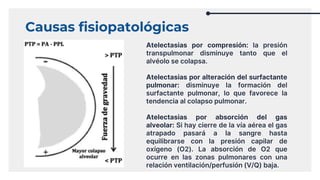 Causas fisiopatológicas
Atelectasias por compresión: la presión
transpulmonar disminuye tanto que el
alvéolo se colapsa.
Atelectasias por alteración del surfactante
pulmonar: disminuye la formación del
surfactante pulmonar, lo que favorece la
tendencia al colapso pulmonar.
Atelectasias por absorción del gas
alveolar: Si hay cierre de la vía aérea el gas
atrapado pasará a la sangre hasta
equilibrarse con la presión capilar de
oxígeno (O2). La absorción de O2 que
ocurre en las zonas pulmonares con una
relación ventilación/perfusión (V/Q) baja.
 