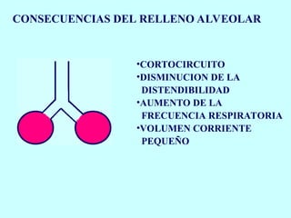 CONSECUENCIAS DEL RELLENO ALVEOLAR
•CORTOCIRCUITO
•DISMINUCION DE LA
DISTENDIBILIDAD
•AUMENTO DE LA
FRECUENCIA RESPIRATORIA
•VOLUMEN CORRIENTE
PEQUEÑO
 