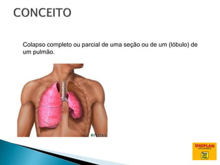 Colapso completo ou parcial de uma seção ou de um (lóbulo) de
um pulmão.
 