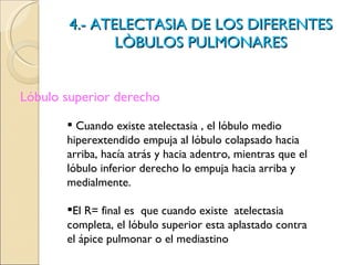 4.- ATELECTASIA DE LOS DIFERENTES LÒBULOS PULMONARES Lóbulo superior derecho <ul><li>Cuando existe atelectasia , el lóbulo...