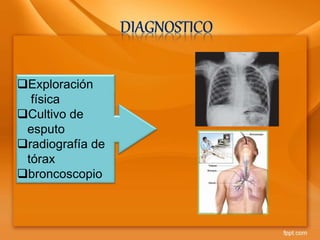 Exploración
física
Cultivo de
esputo
radiografía de
tórax
broncoscopio
 