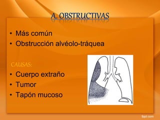 • Más común
• Obstrucción alvéolo-tráquea
CAUSAS:
• Cuerpo extraño
• Tumor
• Tapón mucoso
 