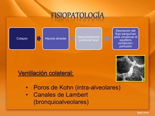 Colapso Hipoxia alveolar
Vasoconstricción
pulmonar local
Desviación del
flujo sanguíneo
para conservar el
equilibrio
ventilación-
perfusión
Ventilación colateral:
• Poros de Kohn (intra-alveolares)
• Canales de Lambert
(bronquioalveolares)
 