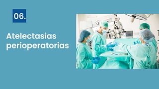 Atelectasias
perioperatorias
06.
 