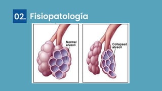 Fisiopatología
02.
 