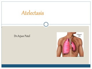dr
Atelectasis
Dr.Arjun Patel
 