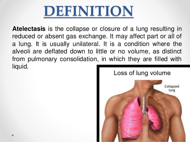 Atelectasis Easy explanation