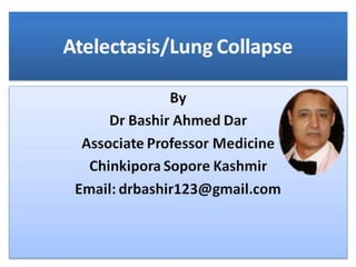 Atelectasis/Lung Collapse Part-1 by Dr Bashir Ahmed Dar Associate Professor Medicine Sopore Kashmir