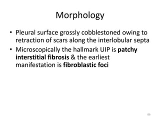 Morphology
• Pleural surface grossly cobblestoned owing to
retraction of scars along the interlobular septa
• Microscopically the hallmark UIP is patchy
interstitial fibrosis & the earliest
manifestation is fibroblastic foci
89
 