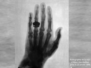 Radiographie de la main
 d’Albert Von Kolliker
prise le 23 janvier 1896
 