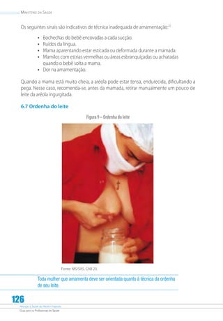 Atenção à Saúde do Recém-Nascido
Guia para os Profissionais de Saúde
126
Ministério da Saúde
Os seguintes sinais são indicativos de técnica inadequada de amamentação:22
•	 Bochechas do bebê encovadas a cada sucção.
•	 Ruídos da língua.
•	 Mama aparentando estar esticada ou deformada durante a mamada.
•	 Mamilos com estrias vermelhas ou áreas esbranquiçadas ou achatadas
quando o bebê solta a mama.
•	 Dor na amamentação.
Quando a mama está muito cheia, a aréola pode estar tensa, endurecida, dificultando a
pega. Nesse caso, recomenda-se, antes da mamada, retirar manualmente um pouco de
leite da aréola ingurgitada.
6.7 Ordenha do leite
Figura9–Ordenhadoleite
Fonte: MS/SAS. CAB 23.
Toda mulher que amamenta deve ser orientada quanto à técnica da ordenha
de seu leite.
 
