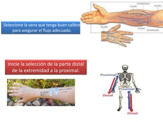 Inicie la selección de la parte distal
de la extremidad a la proximal.
Seleccione la vena que tenga buen calibre
para asegurar el flujo adecuado.
 